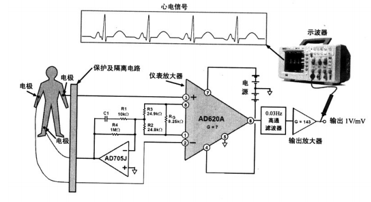 放大器