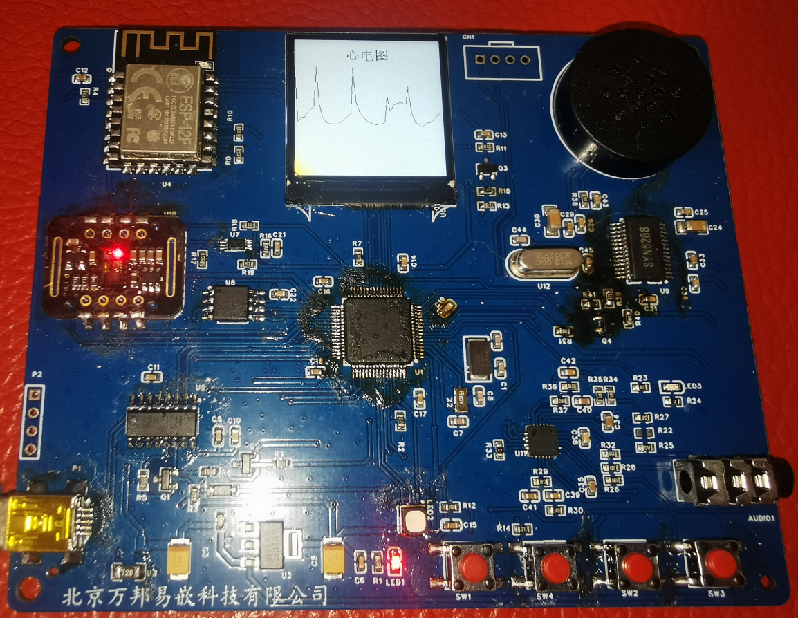 STM32