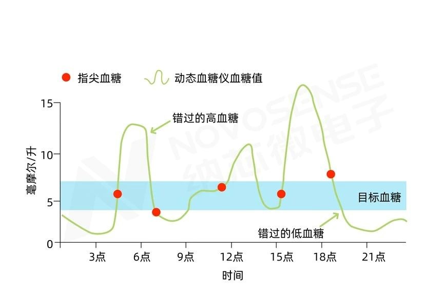 CGM